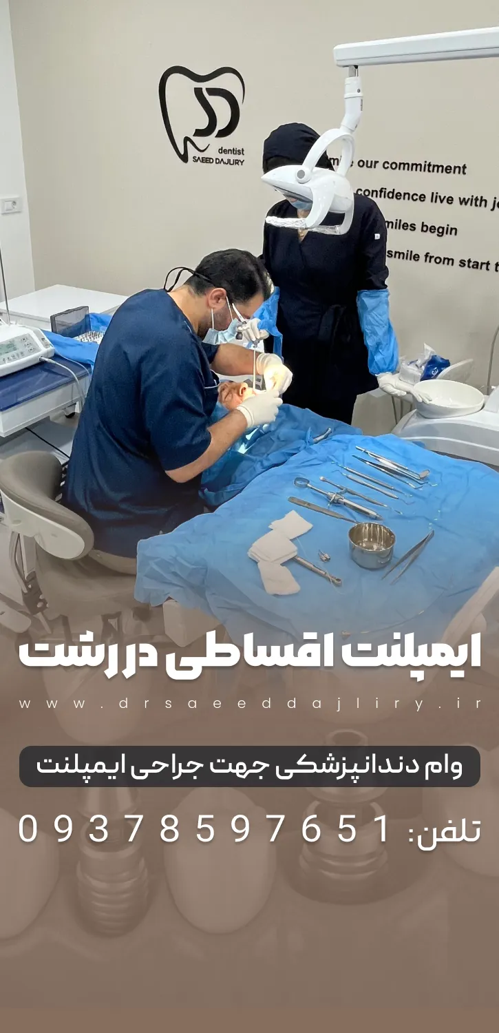 ایمپلنت اقساطی در رشت