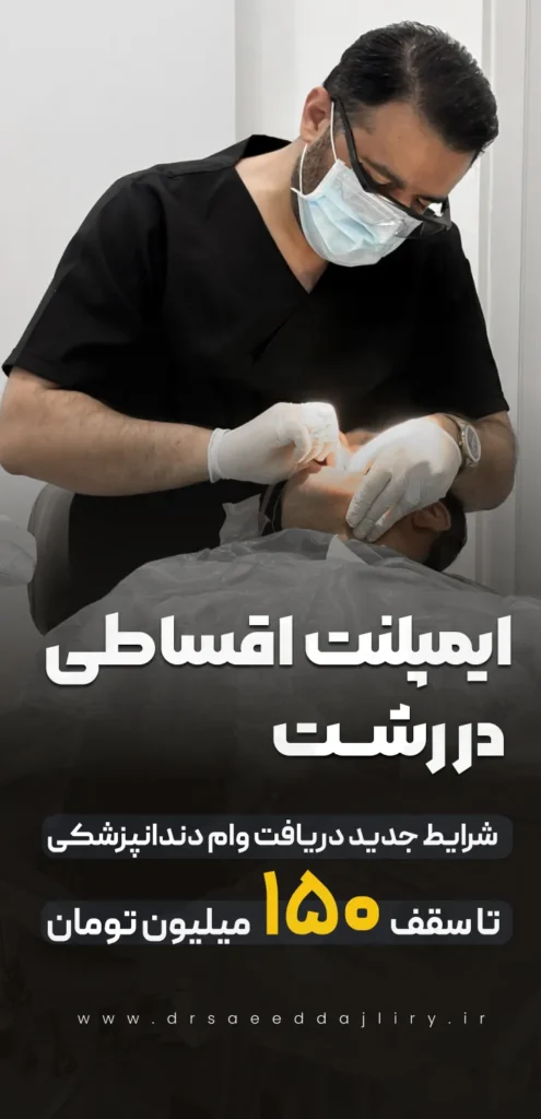 ایمپلنت اقساطی در رشت