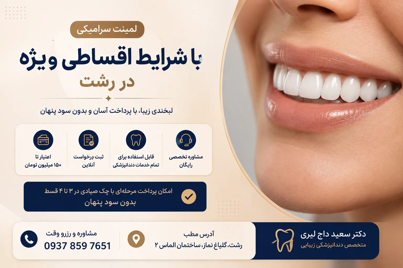 لمینت سرامیکی با شرایط اقساطی ویژه در رشت