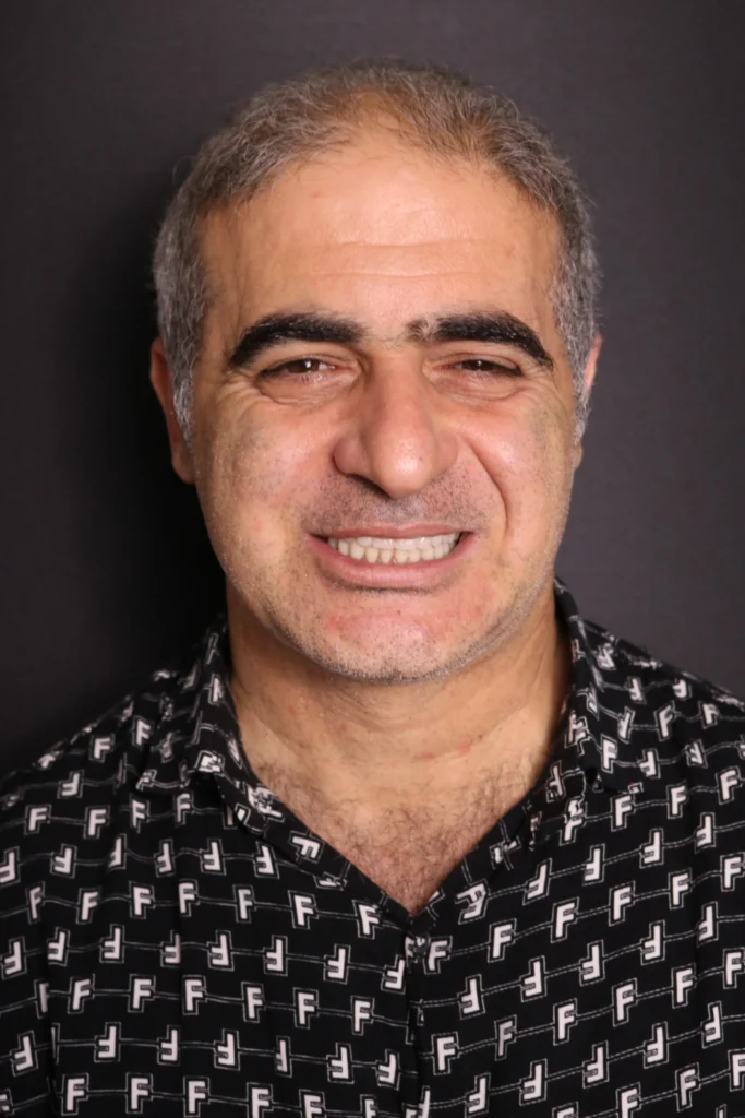 درمان ایمپلنت اوردنچر در رشت